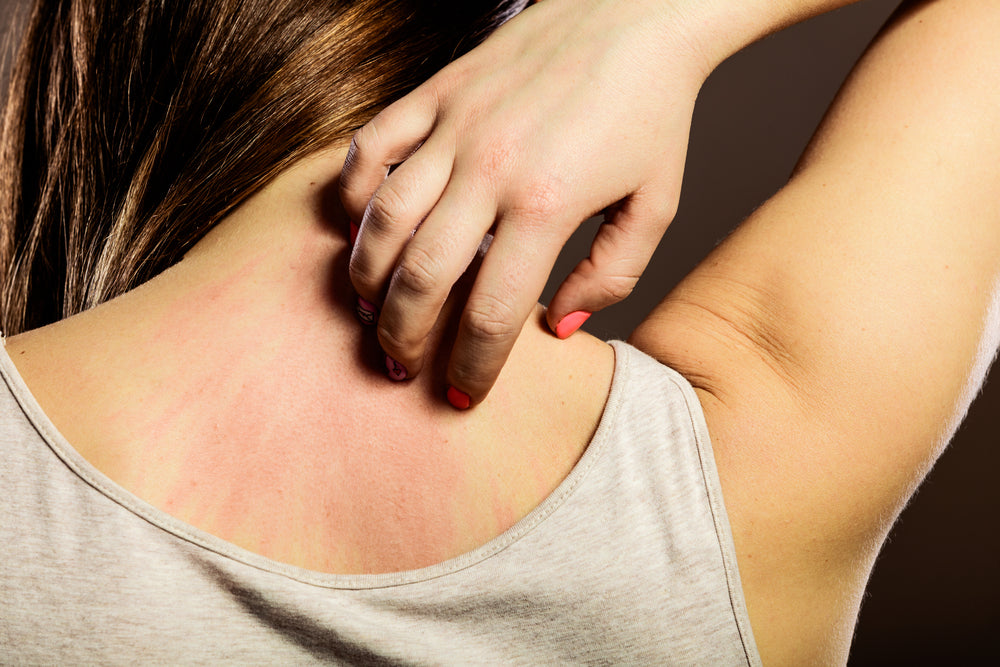 Omgaan met Jeukende Huid na Massage: Hoe Voorkom Je Huidirritatie?